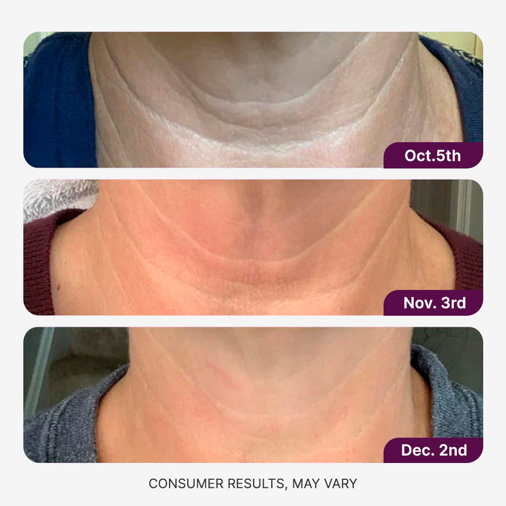 Neck Revival Cream